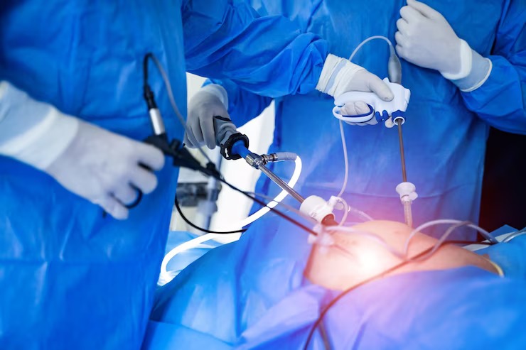 Surgical Procedure